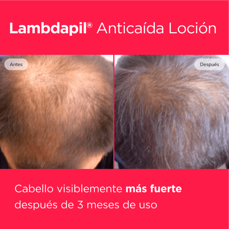 lambdapil-caida-capilar-fortalece-cabello